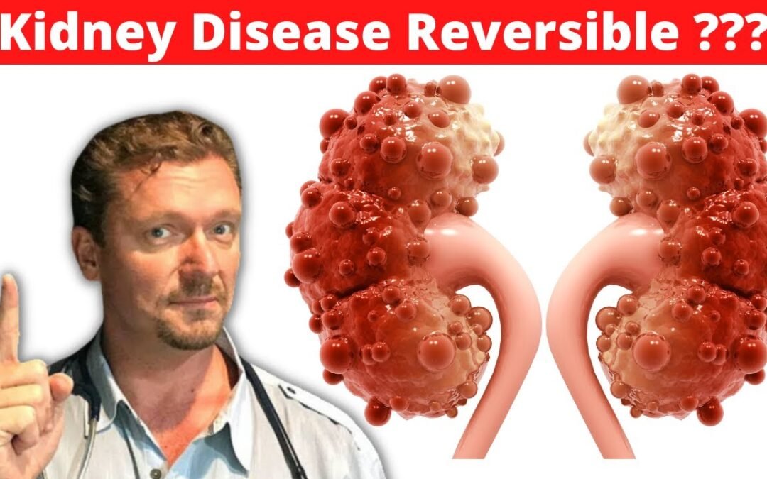 Reverse Chronic Kidney Disease (CKD) [Improve Kidney Function with Diet] 2024