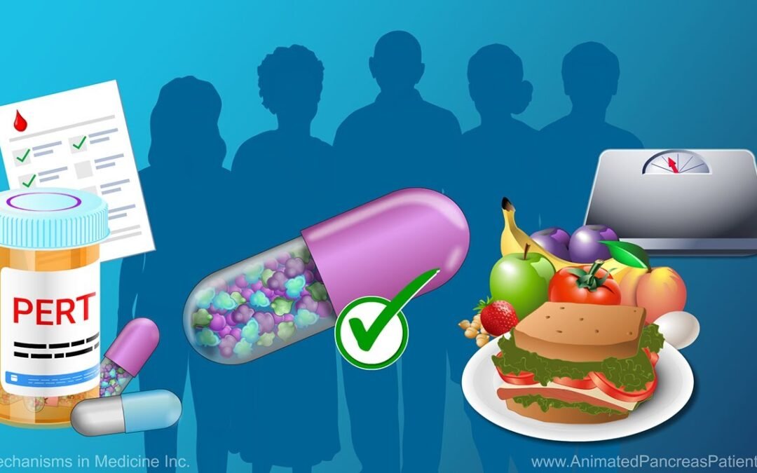 Chronic Pancreatitis Nutrition Management