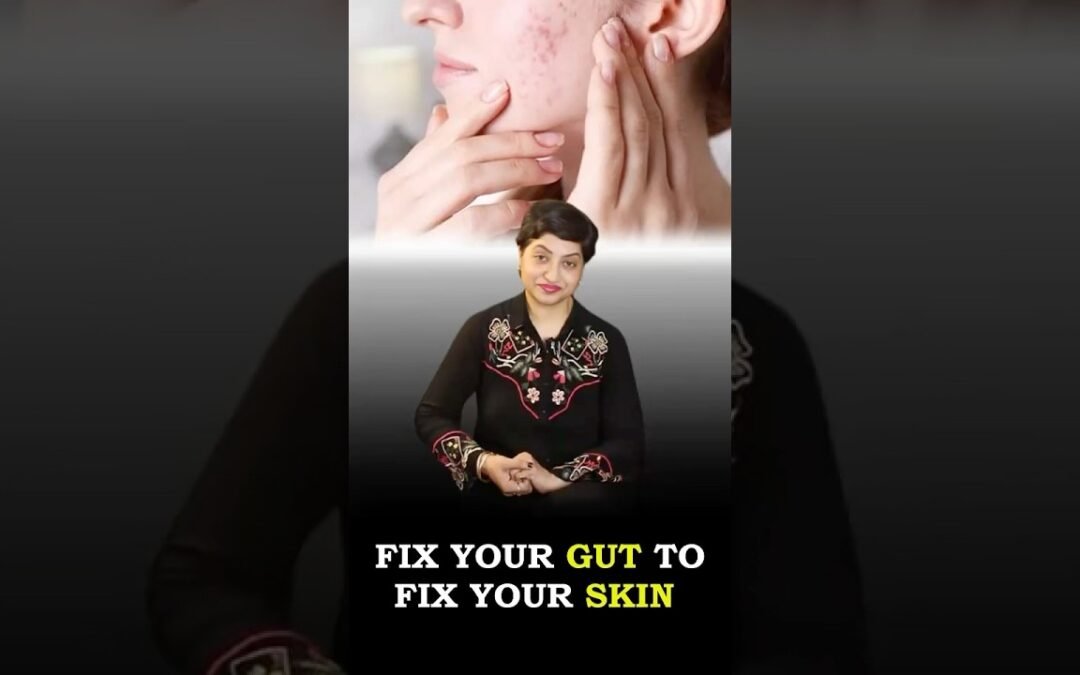 The Link Between Digestive Health & Clear Skin |Connection Between Acne, Gut Health, & Skin Problems