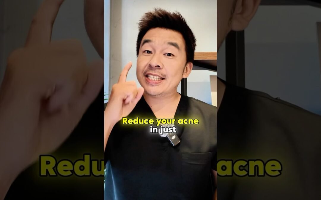 Reduce your acne with anti inflammatory.