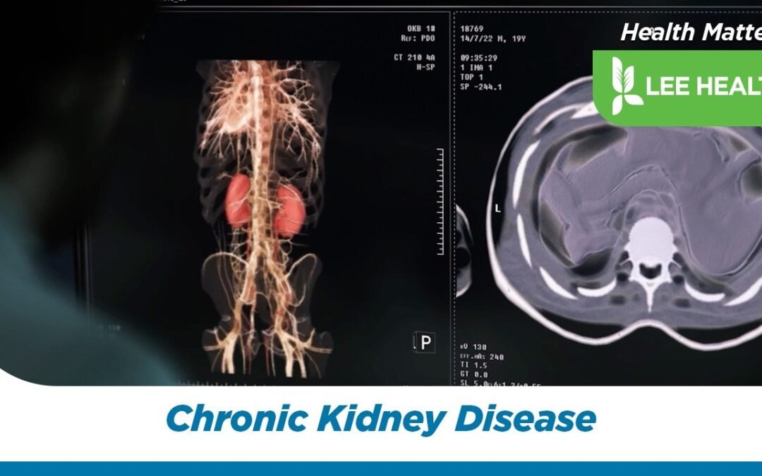Chronic Kidney Disease